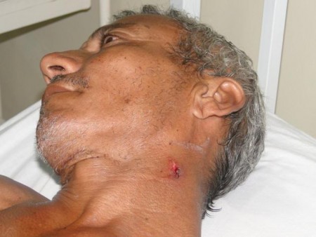 Briga entre irmãos quase acaba em tragédia; um deles saiu ferido com tiro no pescoço